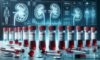 Kidney Blood Test in Blackburn: Essential Information Guide