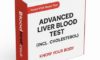 Blood Alcohol Level Testing: Your Comprehensive Guide